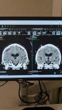MRI